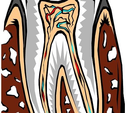 Schmerzempfindliche Zähne – woher kommt’s und was hilft?