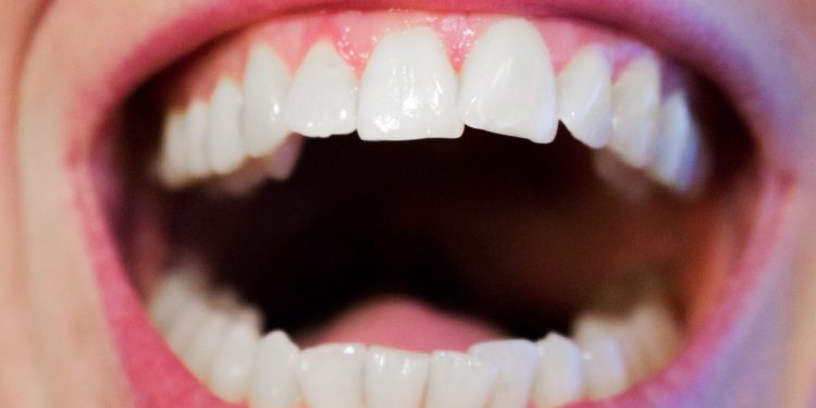 Aligner und Co. – ästhetische Zähne im Erwachsenenalter