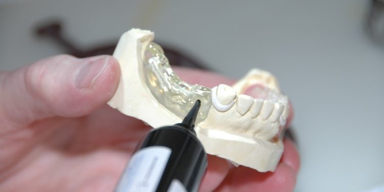 Welche Produkte zählen zum Dentalbedarf in einem Zahnlabor?
