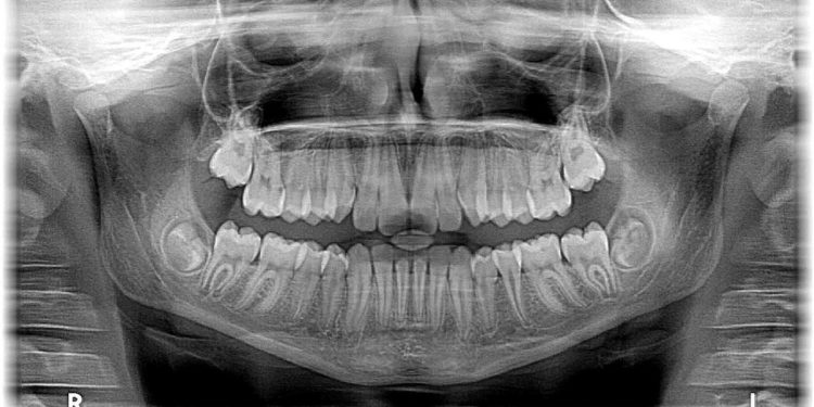 Was versteht man unter Oralchirurgie?