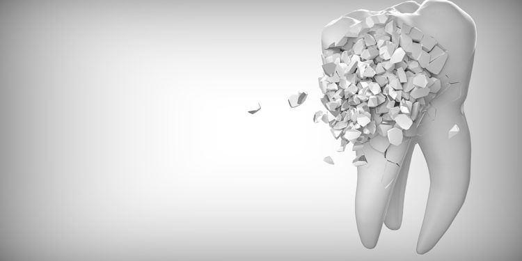 Das müssen Sie zu einer Zahnzusatzversicherung wissen!