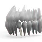 Zahnimplantate – was Patienten wissen müssen